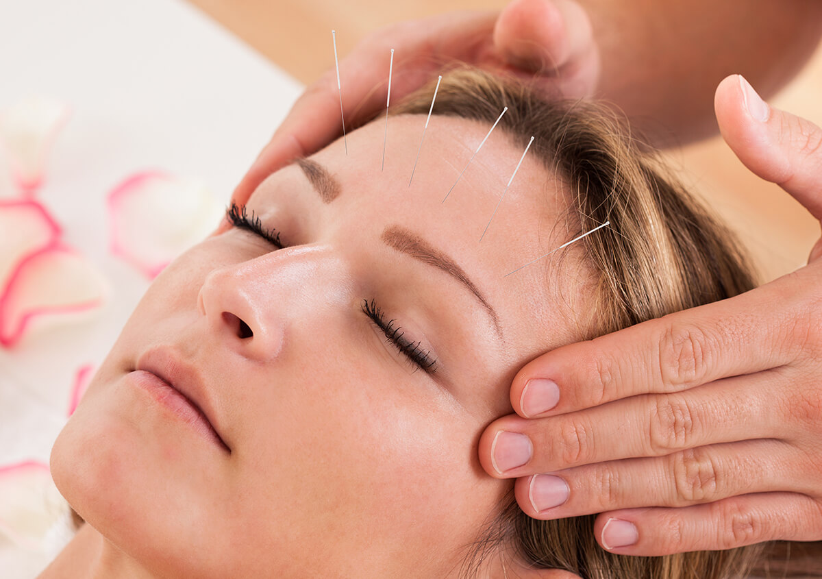 Acupuncture for Chronic Pain in NYC Area