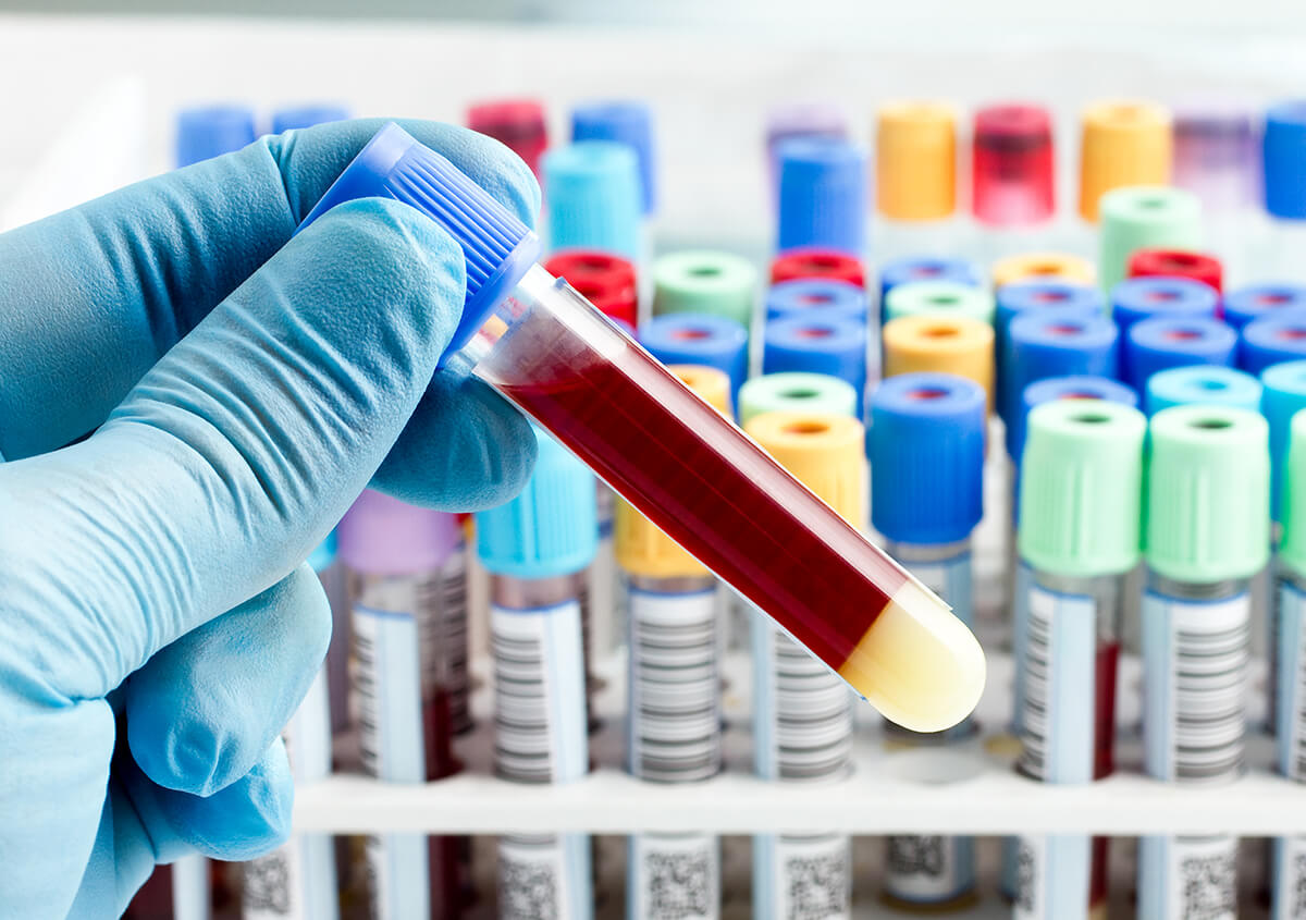 Comprehensive Blood Test Rye in Brook NY Area