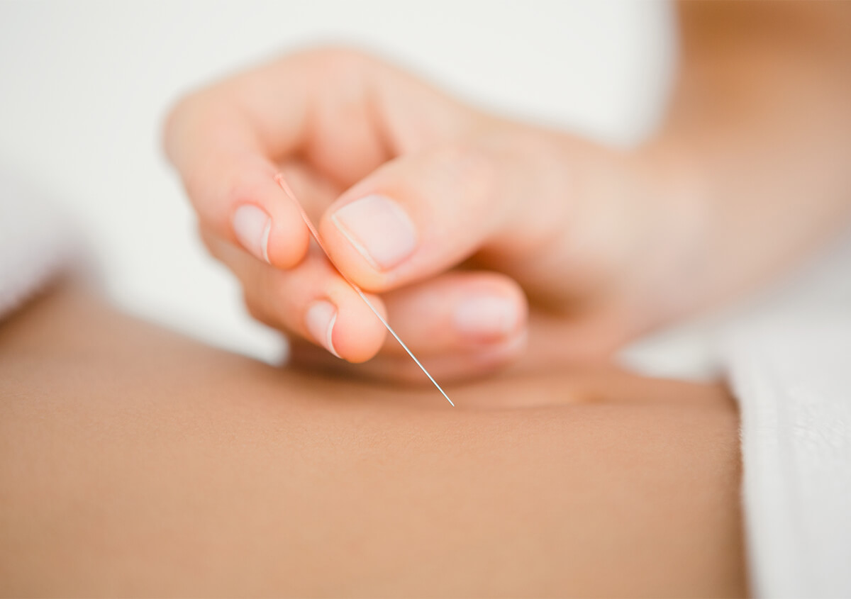 Safety and Risks of Acupuncture Treatment in Manhattan Area