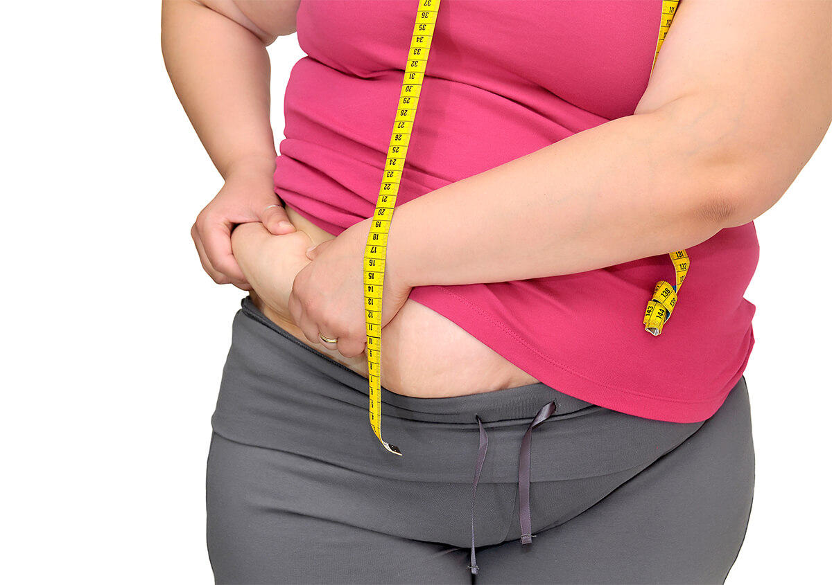 Excess Body Weight Loss in Manhattan Area