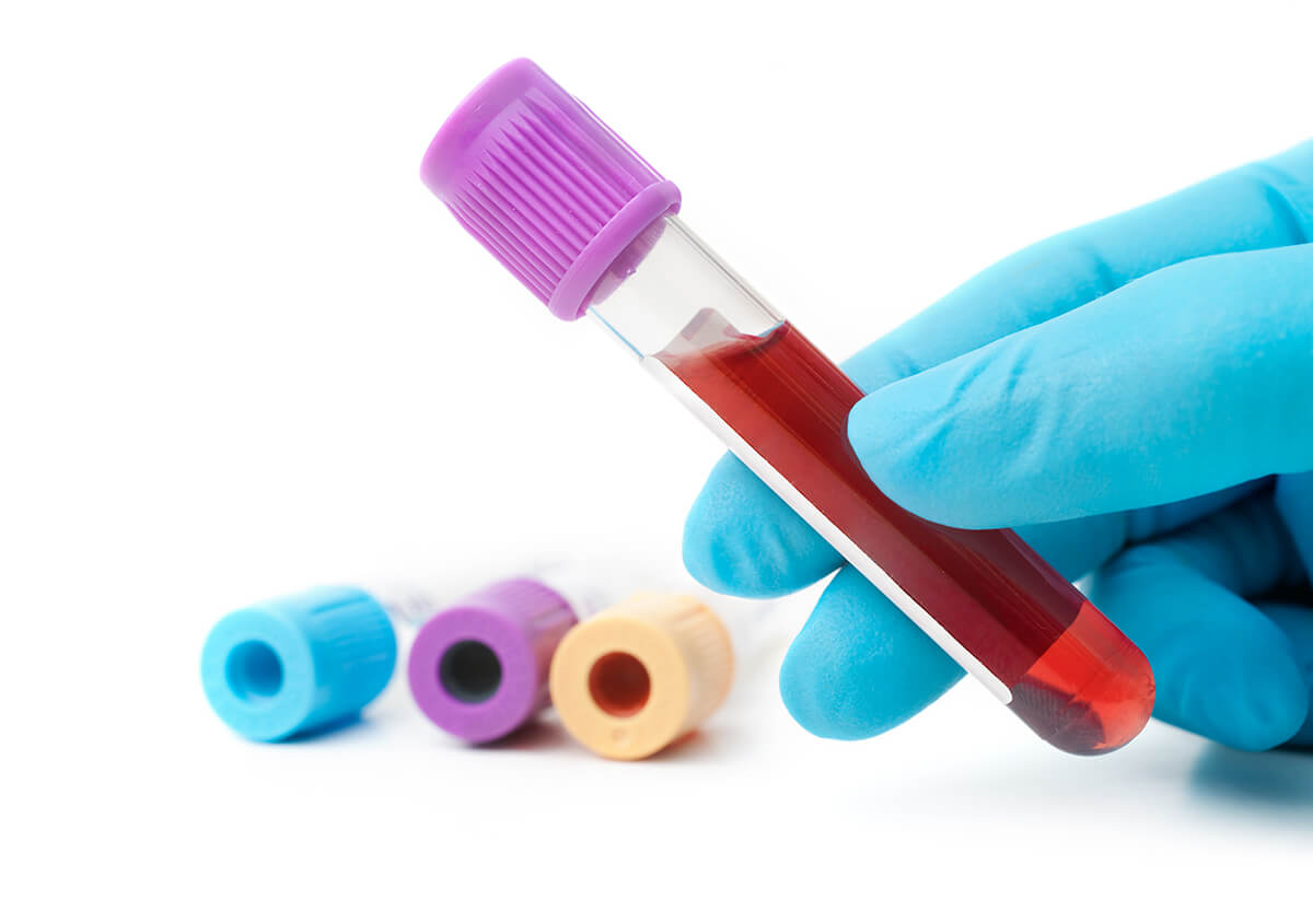 Comprehensive Blood Testing in Manhattan Area